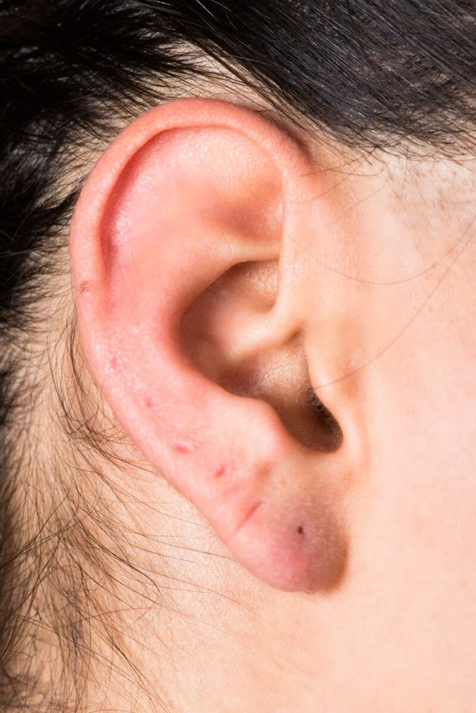 ear piercing closing up earring holes